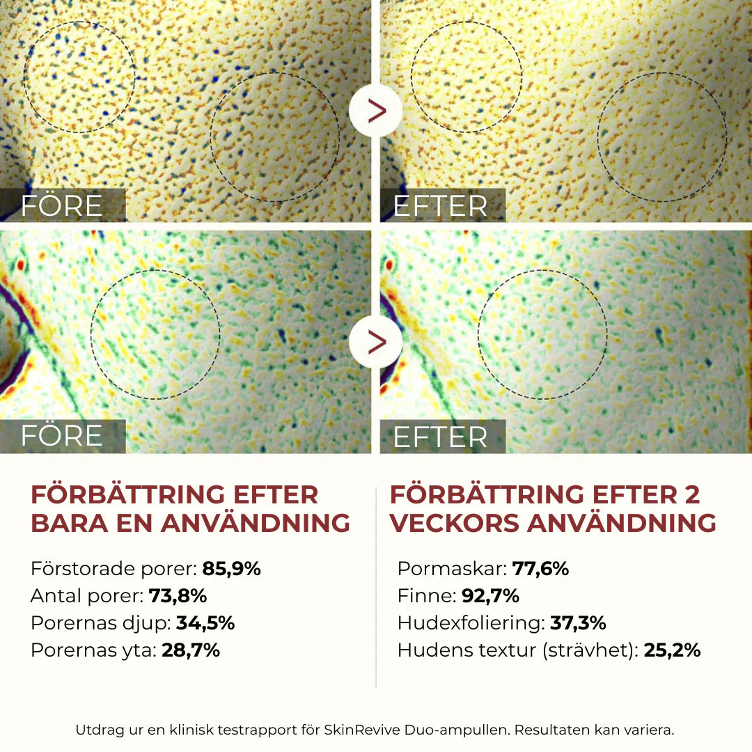 Peelshot- Din 60 sekunders hudförvandling