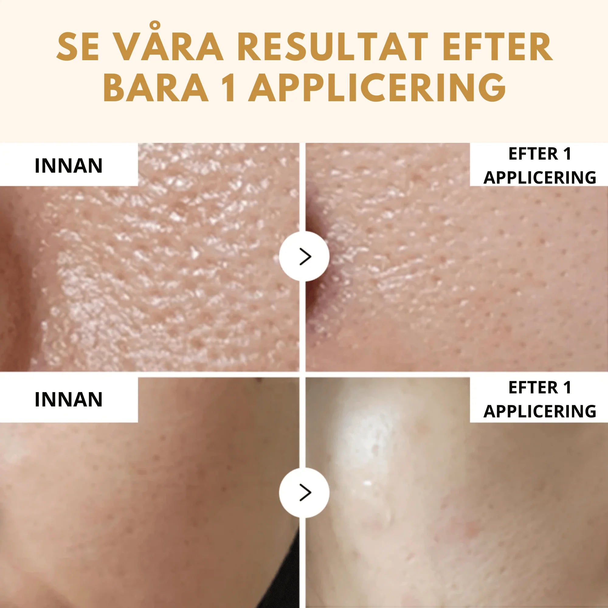 Peelshot- Din 60 sekunders hudförvandling